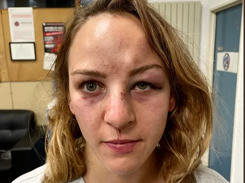 « Que manquait-il ? La mort au bout, peut-être ? » : la judoka...